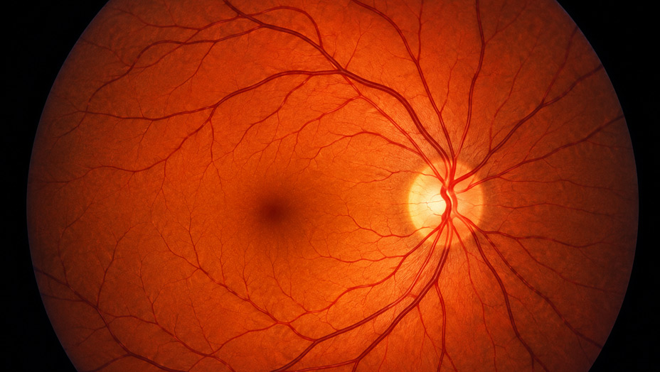 Retina & Fundo de Olho